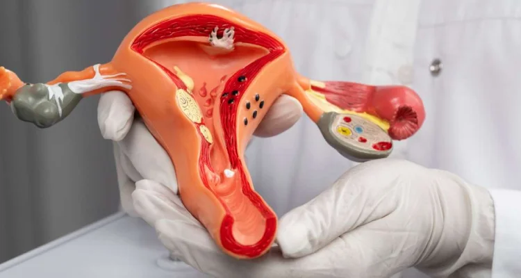 Non-Invasive Fibroid Treatments